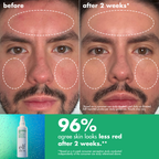 Save Your e.l.f. Hypochlorous Mist
